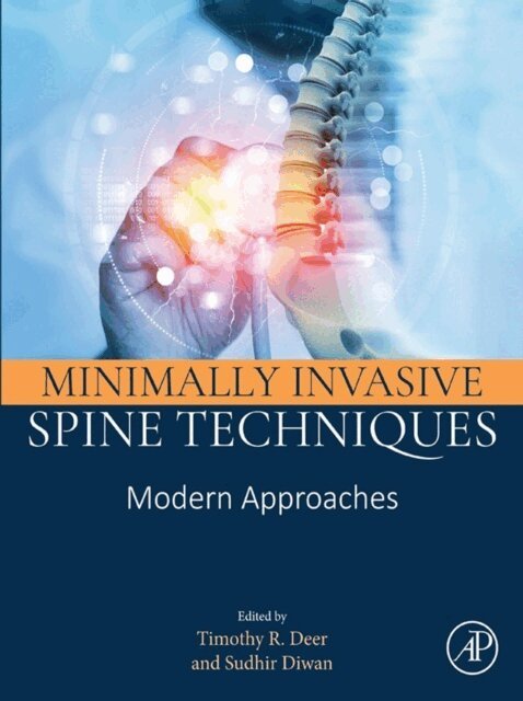 Sudhir Diwan, Timothy R. Deer - Minimally Invasive Spine Techniques, E-bok