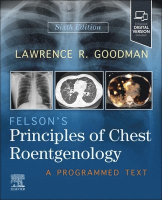Lawrence R. Goodman - Felson's Principles of Chest Roentgenology, Häftad. Tillgänglighet: Kommande