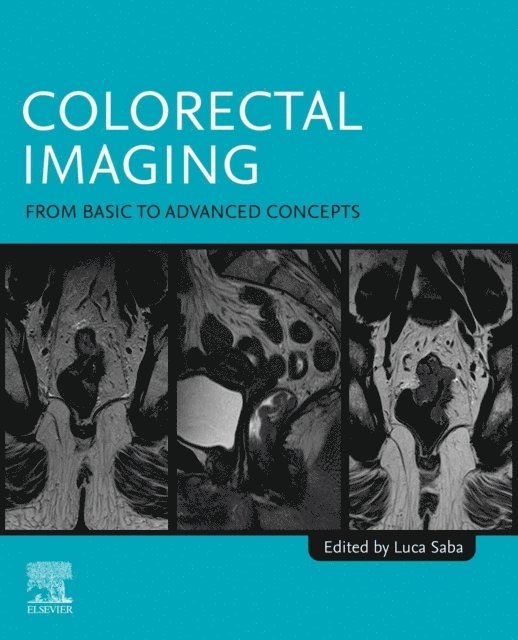 Luca Saba - Colorectal Imaging, E-bok