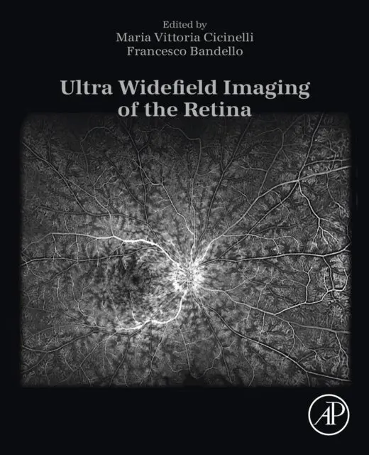 Francesco Bandello, Maria Vittoria Cicinelli - Ultra Widefield Imaging of the Retina, E-bok. Tillgänglighet: Lägg i varukorg