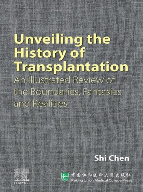 Shi Chen - Unveiling the History of Transplantation, E-bok
