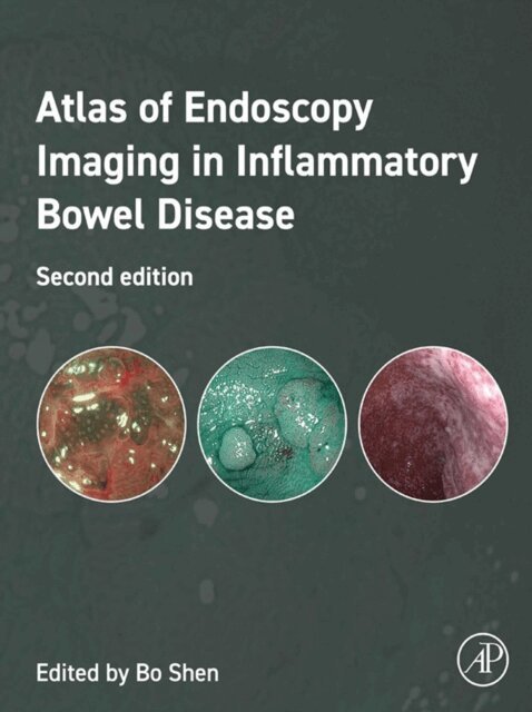 Bo Shen - Atlas of Endoscopy Imaging in Inflammatory Bowel Disease, E-bok