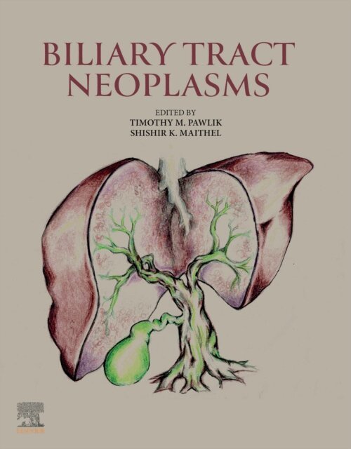 Shishir K. Maithel, Timothy M. Pawlik - Biliary Tract Neoplasms, E-bok