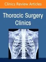 Sihag,Smit, Smita Sihag, Mara B. Antonoff - Pulmonary Metastasectomy, An Issue of Thoracic Surgery Clinics, Inbunden. Tillgänglighet: Lägg i varukorg