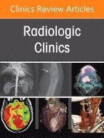Chang,Kevin J, Kevin J. Chang, Shannon P. Sheedy - Imaging of the Small Bowel and Colon, An Issue of Radiologic Clinics of North America, Inbunden