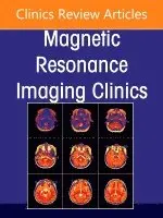 Torres,Carlos H, Carlos H. Torres, Roy Riascos - Spine Imaging, An Issue of Magnetic Resonance Imaging Clinics of North America, Inbunden. Tillgänglighet: Lägg i varukorg