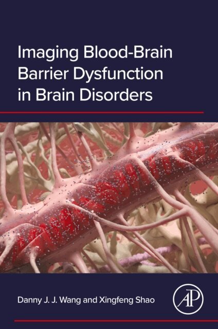 Xingfeng Shao, Danny J.J. Wang - Imaging Blood-Brain Barrier Dysfunction in Brain Disorders, E-bok. Tillgänglighet: Lägg i varukorg