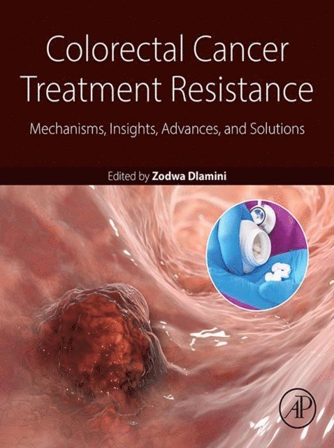 Zodwa Dlamini - Colorectal Cancer Treatment Resistance, E-bok