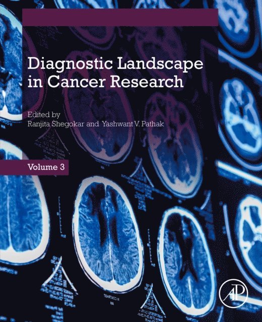 Yashwant Pathak, Ranjita Shegokar - Diagnostic Landscape in Cancer  Research, E-bok