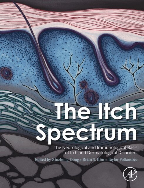 Taylor Follansbee, Brian S. Kim, Xinzhong Dong - Itch Spectrum, E-bok. Tillgänglighet: Lägg i varukorg