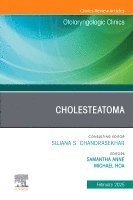 Samantha Anne, Michael Hoa - Cholesteatoma, An Issue of Otolaryngologic Clinics of North America, Inbunden. Tillgänglighet: Lägg i varukorg