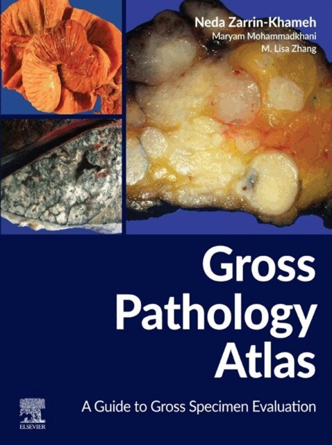 Mingjuan L. Zhang, Maryam Mohammadkhani, Neda Zarrin-Khameh - Gross Pathology Atlas, E-bok. Tillgänglighet: Lägg i varukorg