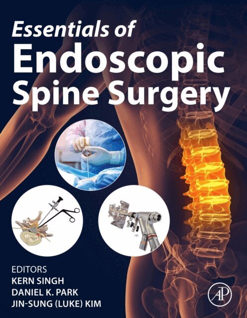 Jin-Sung (Luke) Kim, Daniel K. Park, Kern Singh - Essentials of Endoscopic Spine Surgery, E-bok