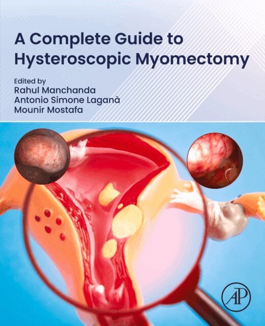 Mounir Mostafa, Antonio Simone Lagana, Rahul Manchanda - Complete Guide to Hysteroscopic Myomectomy, E-bok