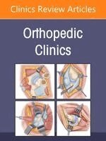 Frederick M. Azar - Minimally Invasive Surgery, An Issue of Orthopedic Clinics, Inbunden