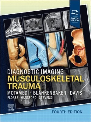 Kambiz Motamedi, Donna G. Blankenbaker, Kirkland W. Davis - Diagnostic Imaging: Musculoskeletal Trauma, Inbunden