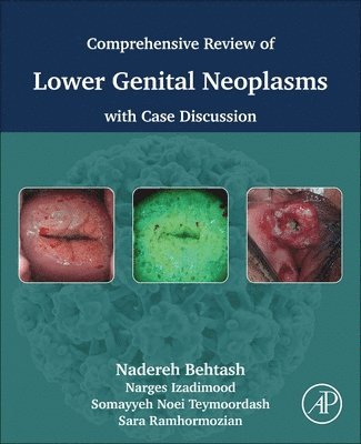 Nadereh Behtash, Narges Izadimood, Sara Ramhormozian, Somayyeh Noei Teymoordash - Comprehensive review of lower genital neoplasms, Häftad. Tillgänglighet: Lägg i varukorg