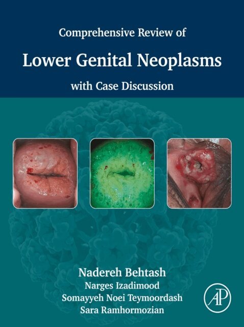 Somayyeh Noei Teymoordash, Sara Ramhormozian, Narges Izadimood, Nadereh Behtash - Comprehensive review of lower genital neoplasms, E-bok. Tillgänglighet: Lägg i varukorg