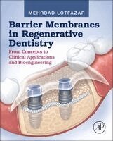 Barrier Membranes in Regenerative Dentistry