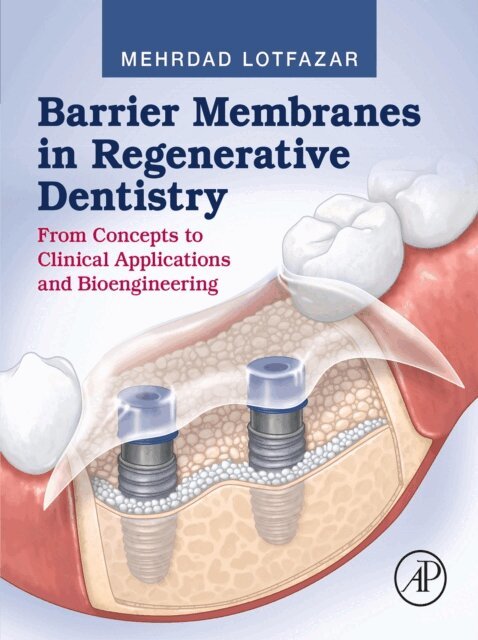 Mehrdad Lotfazar - Barrier Membranes in Regenerative Dentistry, E-bok. Tillgänglighet: Lägg i varukorg