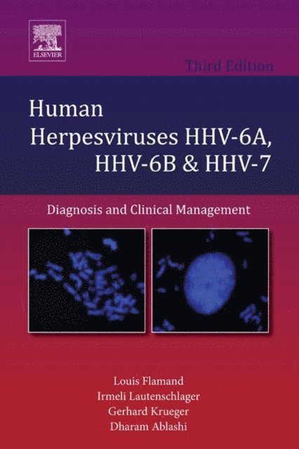 Dharam Ablashi, Gerhard Krueger, Irmeli Lautenschlager, Louis Flamand - Human Herpesviruses HHV-6A, HHV-6B and HHV-7, E-bok