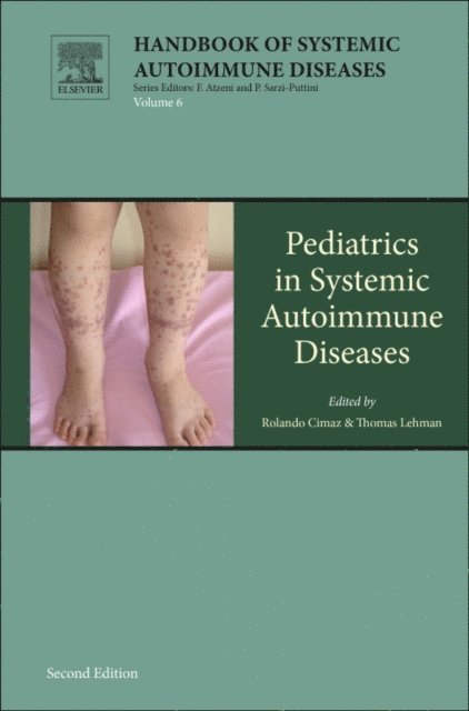 Thomas J.A. Lehman, Rolando Cimaz - Pediatrics in Systemic Autoimmune Diseases, E-bok