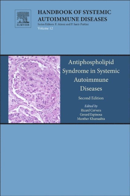 Gerard Espinosa, Munther Khamashta, Joan Carles Reverter, R. Cervera - Antiphospholipid Syndrome in Systemic Autoimmune Diseases, E-bok