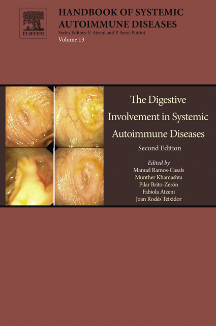 Joan Rodes, Fabiola Atzeni, Pilar Brito-Zeron, Munther Khamashta, Manuel Ramos-Casals - Digestive Involvement in Systemic Autoimmune Diseases, E-bok