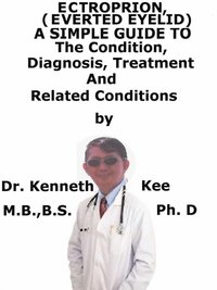 Ectropion, (Everted Eyelid) A Simple Guide To The Condition, Diagnosis, Treatment And Related Conditions