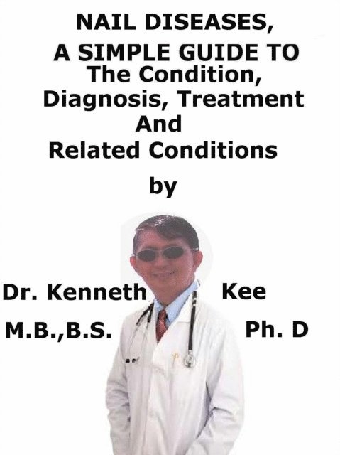Kenneth Kee - Nail Diseases, A Simple Guide To The Condition, Diagnosis, Treatment And Related Conditions, E-bok. Tillgänglighet: Lägg i varukorg