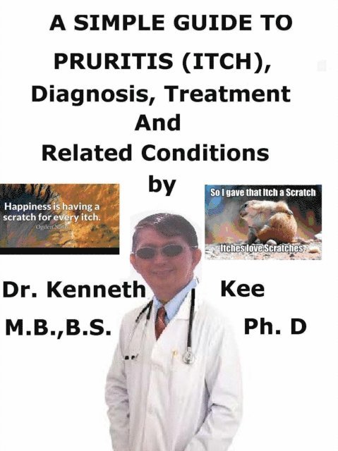 Kenneth Kee - Simple Guide to Pruritis (Itch), Diagnosis, Treatment and Related Conditions, E-bok. Tillgänglighet: Lägg i varukorg