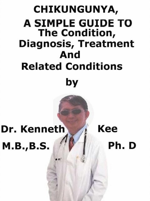 Kenneth Kee - Chikungunya, A Simple Guide To The Condition, Diagnosis, Treatment And Related Conditions, E-bok. Tillgänglighet: Lägg i varukorg
