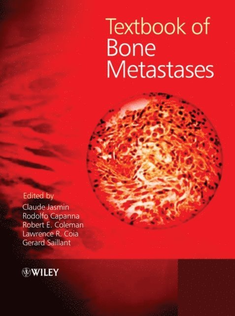 Gerard Saillant, Robert Coleman, Lawrence Coia, Rodolfo Capanna, Claude Jasmin - Textbook of Bone Metastases, E-bok