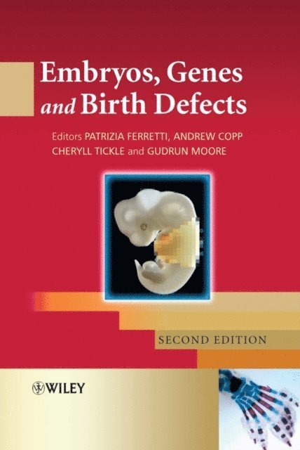Gudrun Moore, Cheryll Tickle, Andrew Copp, Patrizia Ferretti - Embryos, Genes and Birth Defects, E-bok