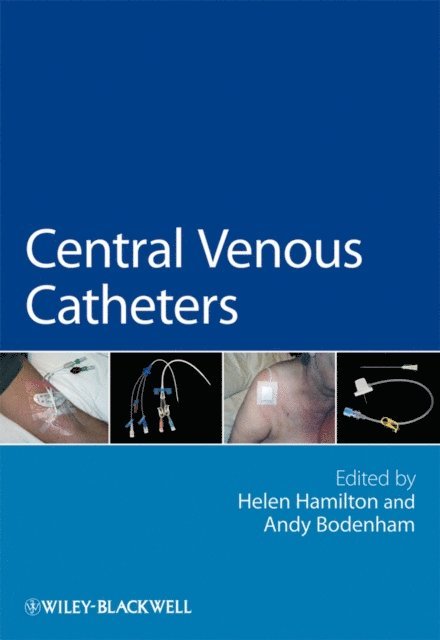Andy Bodenham, Helen Hamilton - Central Venous Catheters, E-bok