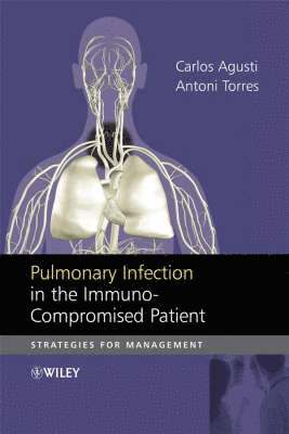 Carlos Agusti, Antoni Torres - Pulmonary Infection in the Immunocompromised Patient, Inbunden