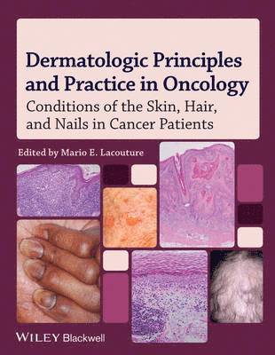 Dermatologic Principles and Practice in Oncology