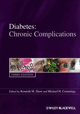 Kenneth M. Shaw, Michael H. Cummings - Diabetes, Häftad
