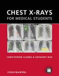 Chest X-rays for Medical Students