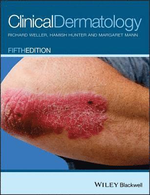 Richard B. Weller, Hamish J. A. Hunter, Margaret W. Mann - Clinical Dermatology, Häftad