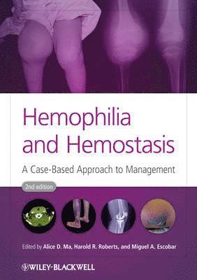 Alice D. Ma, Harold R. Roberts, Miguel A. Escobar - Hemophilia and Hemostasis, Inbunden. Tillgänglighet: Lägg i varukorg