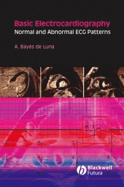 Antoni Bay s de Luna - Basic Electrocardiography, E-bok