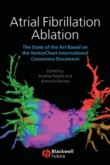 Antonio Raviele, Andrea Natale - Atrial Fibrillation Ablation, E-bok
