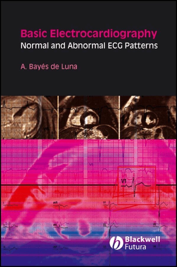 Antoni Bayés de Luna - Basic Electrocardiography – Normal and Abnormal ECG Patterns. Tillgänglighet: Tillfälligt slut