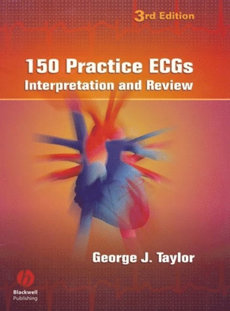 George J. Taylor - 150 Practice ECGs, E-bok