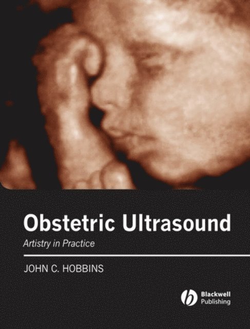 John C. Hobbins - Obstetric Ultrasound, E-bok