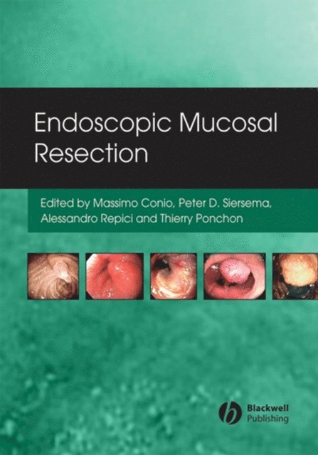 Thierry Ponchon, Alessandro Repici, Pieter Siersema, Massimo Conio - Endoscopic Mucosal Resection, E-bok