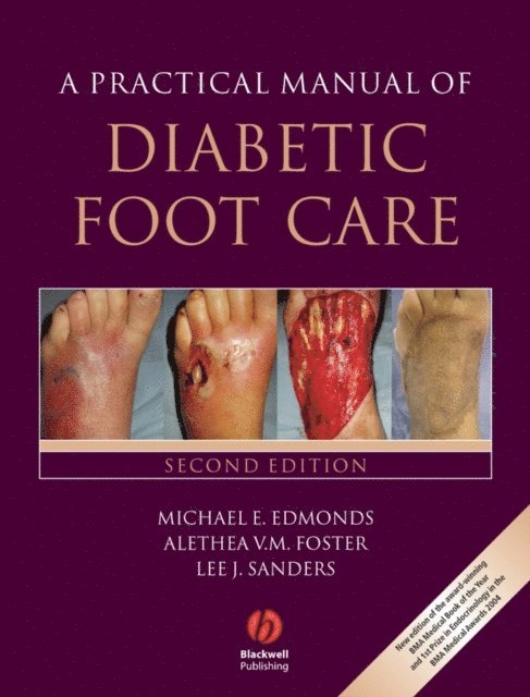 Lee Sanders, Alethea V. M. Foster, Michael E. Edmonds - Practical Manual of Diabetic Foot Care, E-bok. Tillgänglighet: Lägg i varukorg