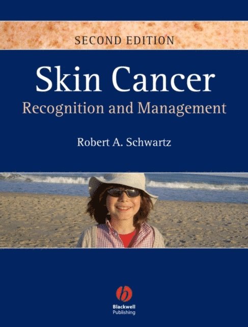 Robert A. Schwartz - Skin Cancer, E-bok