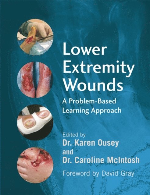 Caroline McIntosh, Karen Ousey - Lower Extremity Wounds, E-bok